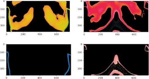 Separaci&oacute;n por KNN con 4 clusters