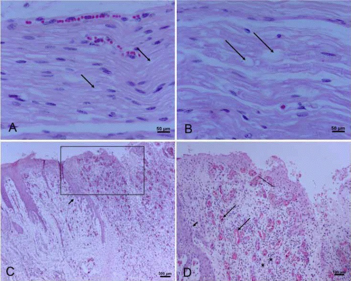 A-B: Peripheral nerve lesions. A) Superficial peroneal nerve. Mild to moderate presence of vacuoles (arrows). B) Recurrent laryngeal nerve. Note bigger vacuoles within the nerve fibers (arrows). C-D: Skin lesion. C) Marked epidermal hyperplasia, with papillae presence (arrow), also severe and extended ulcer with abundant granulation tissue (square). D) At higher magnification note epithelial hyperplasia (short arrow) and abundant granulation with neovascularization processes (long arrows) and inflammatory reaction presence (stars).
