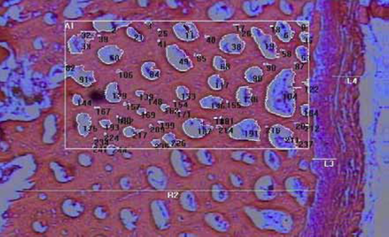 Cross section of a pig rib (pig weight: 90 Kg). Details: (L4) muscle tissue; (L3) periosteum; and (R2) compact tissue, in which an area (A1) and demineralized zones (number) are highlighted. Magnification: 40 X, Color: hematoxylin-eosin (HE).