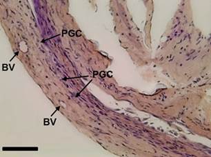 Longitudinal section of an undifferentiated gonad of Rhamdia quelen showing the blood vessels (BV) and the primordial germ cells (PGC) in fish at 150 days post-hatching. Staining: Schiff&rsquo;s periodic acid + iron hematoxylin + Metanil Yellow (MY). Bar: 20 &micro;m.