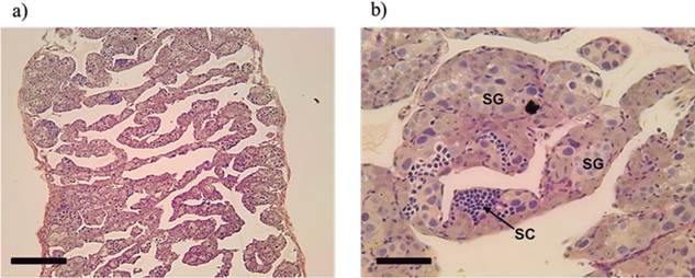 Longitudinal section of masculinized gonads Rhamdia quelen (neomales) (a) Lamellae exclusively containing ovarian male germline cells. (b) Details of spermatogonia (SG) and spermatocytes (SC) present in the lamellae. Staining: Schiff&rsquo;s periodic acid + iron hematoxylin + Metanil Yellow (MY). Fish at 150 days post-hatching. Bars: 200 (a) and 20 &micro;m (b).