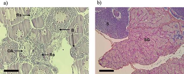 Longitudinal sections showing inhibitory effects on gonadal development in Rhamdia quelen caused by masculinizing hormone 17α-methyltestosterone. (a) Ovary showing reabsorption areas (Rs) and reorganization (Ro) cells, the presence of oocyte atresia (OA), and breakdown (B) of cytoplasm oocyte. (b) Testis showing areas at different stages of development: spermatogonia (SG) and spermatozoa (S). Staining: hematoxylin/eosin (HE) (a) and Schiff&rsquo;s periodic acid + iron hematoxylin + Metanil Yellow (MY) (b). Fish at 150 days post-hatching. Bars: 50 &micro;m.