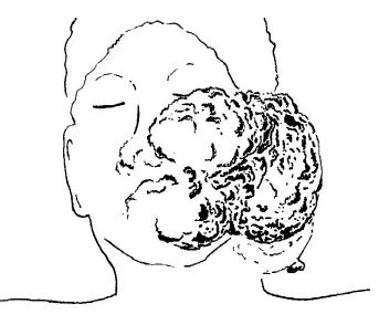 Fisiopatolog&iacute;a del ahogado.2