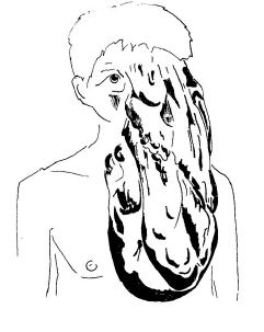 &ldquo;India: Este es el &lsquo;Hombre elefante&rsquo; que no puede ser operado&rdquo;.