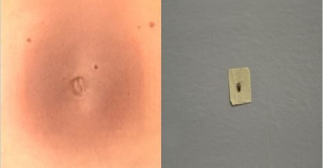 Ombligo y semilla con tinta para sellos elaboración del teorema 1