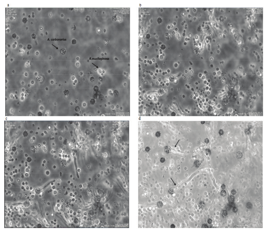 Antagonistic activity at cellular level of Aspergillus carbonarius CCDCA 10408 co-cultivated with Rhodotorula mucilaginosa CCMA 0156, increased 40x, 10 &micro;m. (a) Yeast cells and spores of the fungi after inoculation. (b) Increase on the number of yeast cells and beginning of germination of A. carbonarius spores (4 hours and 39 minutes). (c) Germination of A. carbonarius spores (5 hours and 19 minutes). (d) Observation on the increase of hyphae emitted by the spore of A. carbonarius; it was possible to observe the formation of nuclei after approximately 16 h of incubation. There is also a spore that did not present a very former pressive growth of the hyphae. Images obtained using BioStation IM-Q (Nikon). The pictures are in an augmentation of 40x.