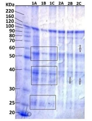 1D SDS-PAGE with the protein profile from axillary buds of sugarcane cv. RB966928: black arrows (and rectangles) indicate differences between first and fifth cut. Lanes 1A- C, first cut; 2A-C, fifth cut; L, ladder.