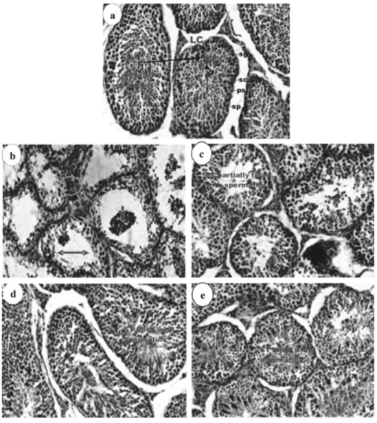A photomicrograph of the testis of cadmium exposed rabbits administered MEPD fruit stained with H&E, 100 X. (a) The control rabbit showing normal appearance of spermatogenic cells; spermatogonia (sg), primary spermatocyte (ps), spermatid (sp), and Sertoli cells (sc). Leydig cells in interstitial tissue are noticed (LC). (b) Cross section of Cd-only treated rabbit showing: degeneration of spermatogenic cells, aggregation of necrotic spermatozoa at the seminiferous tubules (STs) lumen (thick arrow), interstitial haemorrhage (encircled), wide ST lumen (c) Section of rabbit treated with Cd+300 mg kg-1 MEPD showing; aggregation of few necrotic spermatozoa at the STs, mild interstitial haemorrhage (encircled), STs partially filled with spermatozoa. (d-e) sections of rabbits treated with Cd+600 and Cd+900 mg kg-1 MEPD showing; mild vacuolation, STs containing sperms and Sertoli cells are capped by tufts of late spermatids attached by their heads in the lumen.