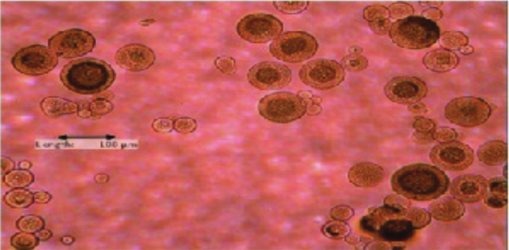 A Microphotograph showing the lipid-walled microcapsule (light microscope Boeco 10 x 10).