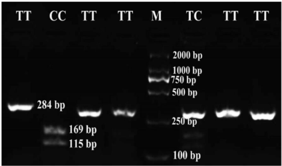 PCR amplified products of LCORL gene digested with AluI in some studied horses. M is DNA size marker and other lanes are TT, TC and CC genotypes.