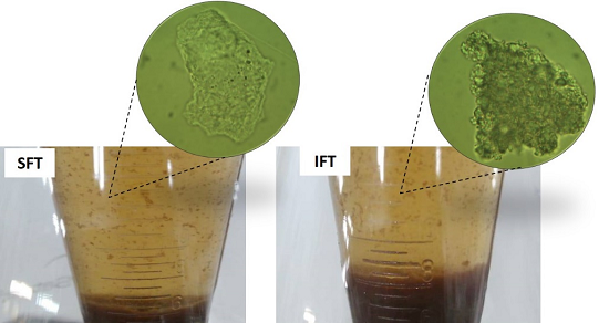 Representation of the structure of the aggregates formed in the two treatments. 