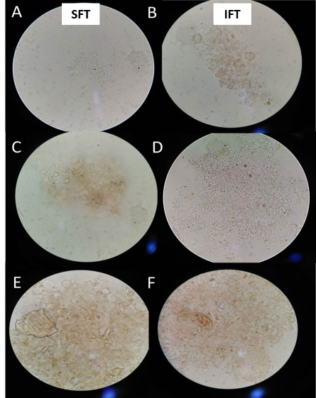 Monitoring of microbial aggregates observed under a microscope throughout the experiment in both treatments. SFT: treatment with spontaneous formation (conventional), IFT: treatment with the introduction of bacteria. A and B: 2th day, C and D: 5th day, E and F: 10th day.