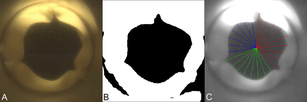 Different moments of signal processing. (A) Original video, (B) threshold showing the leaflets edges, (C) lines created using software to measure the oscillations