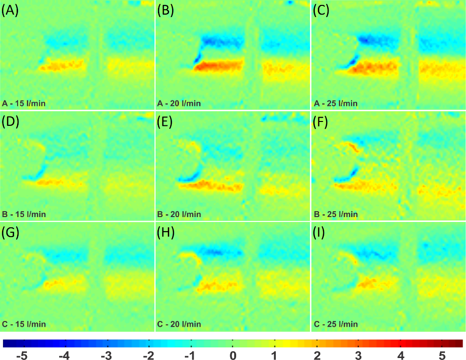 Viscous shear stress in the bovine pericardium valve.