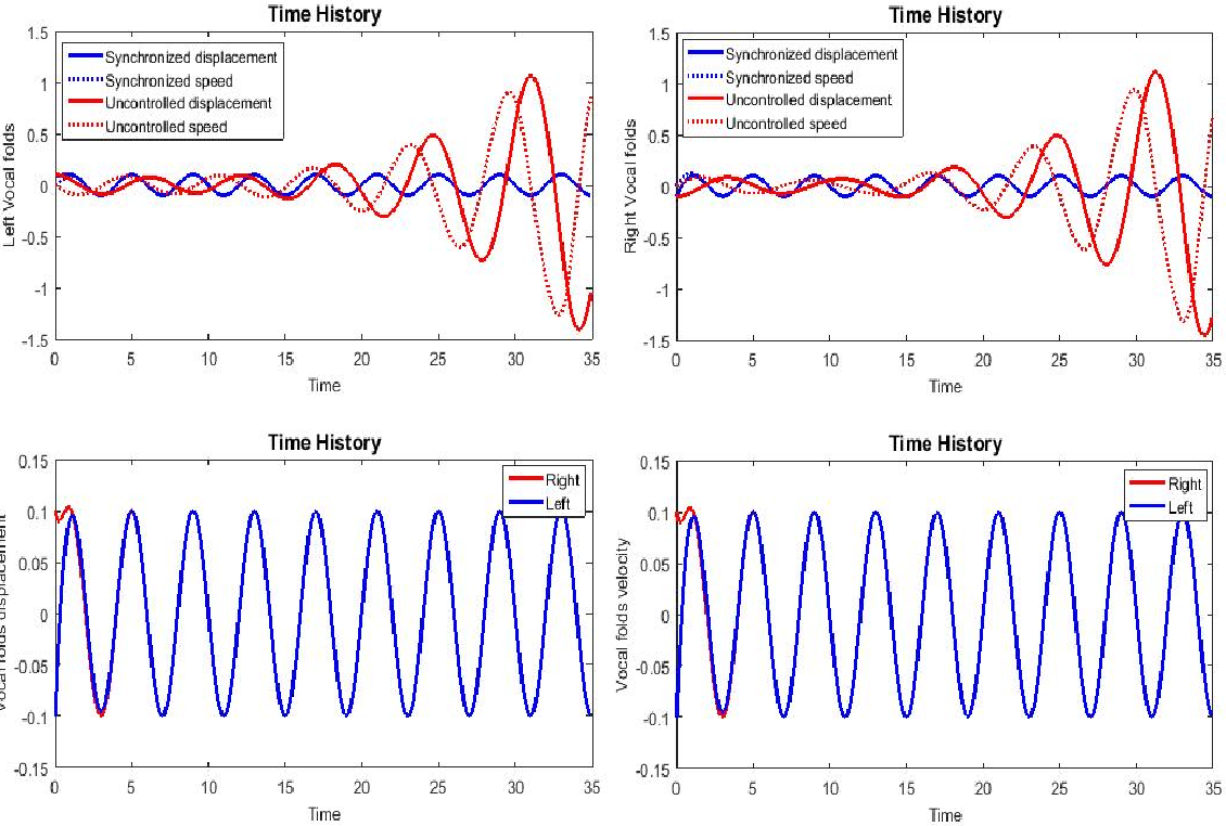 Time history for situation 1, source: author.