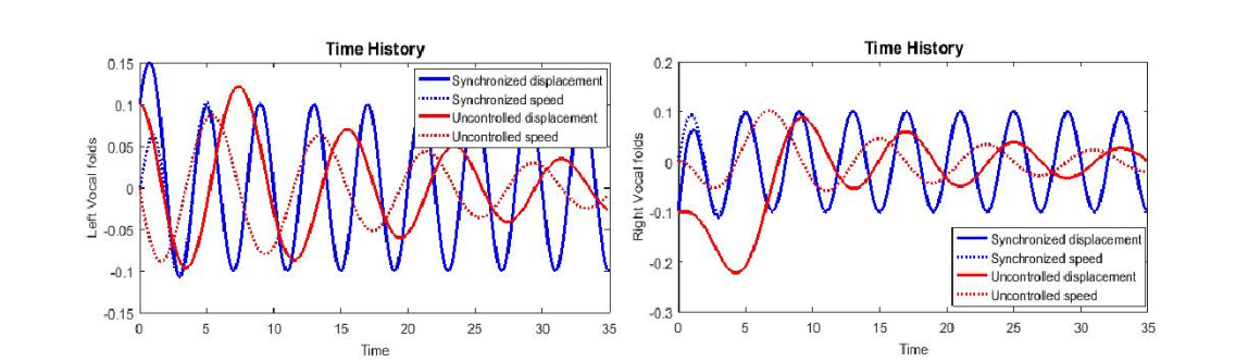 Time history for situation 2, source: author.