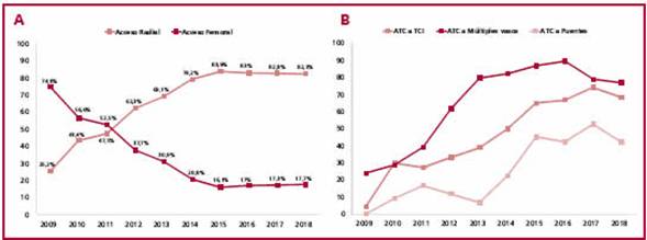En el gr&aacute;fico A, se observa la tendencia en la utilizaci&oacute;n del acceso radial y del acceso femoral en la poblaci&oacute;n general. En el gr&aacute;fico B, se muestra la tendencia creciente a realizar angioplastias complejas por v&iacute;a radial (pt< 0,0001 para todos los grupos).