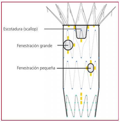 Fig.1. Dispositivo fenestrado Zenith