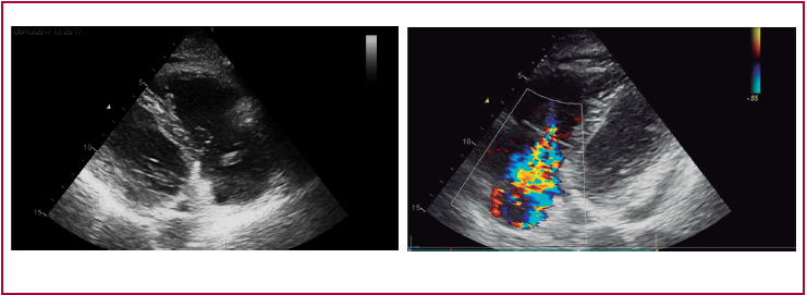 videos complementarios en: https://youtu.be/TYYUziJB2XQ - https://youtu.be/szx_kwaiFe0