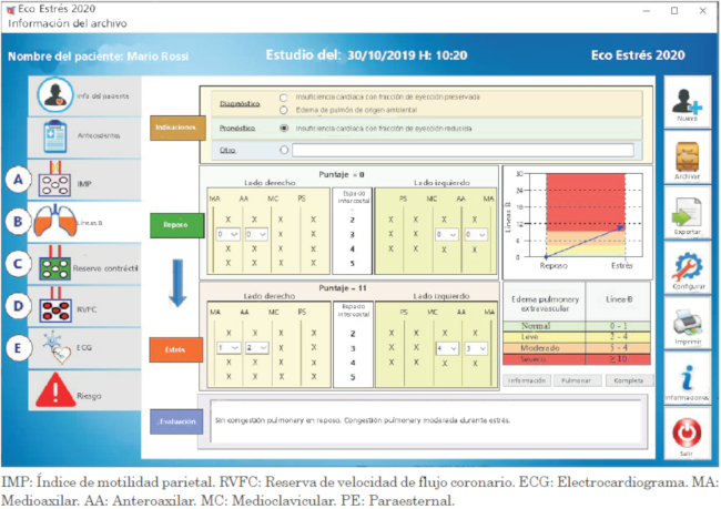 Formulario computarizado de un caso para líneas B pulmonares con escaneo simplificado de 4 sitios (fase B). La gradación de la respuesta se informa en formato tabular (panel derecho superior) y gráfico (panel izquierdo inferior), con el mismo código de colores de la Figura 1 (desde verde, normal, a rojo, anomalía grave)