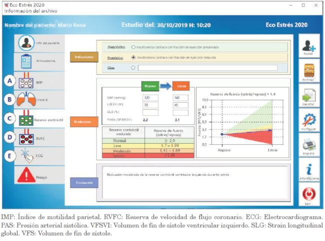 Formulario computarizado de un caso para reserva contráctil ventricular (fase C). Los valores de fuerza ventricular izquierda se derivan de datos crudos de presión sistólica de reposo y pico y de volumen de fin de sístole ventricular izquierda. La gradación de la respuesta se informa en formato tabular (panel derecho superior) y gráfico (panel izquierdo inferior), con el mismo código de colores de la Figura 1 (desde verde, normal, a rojo, anomalía grave).
