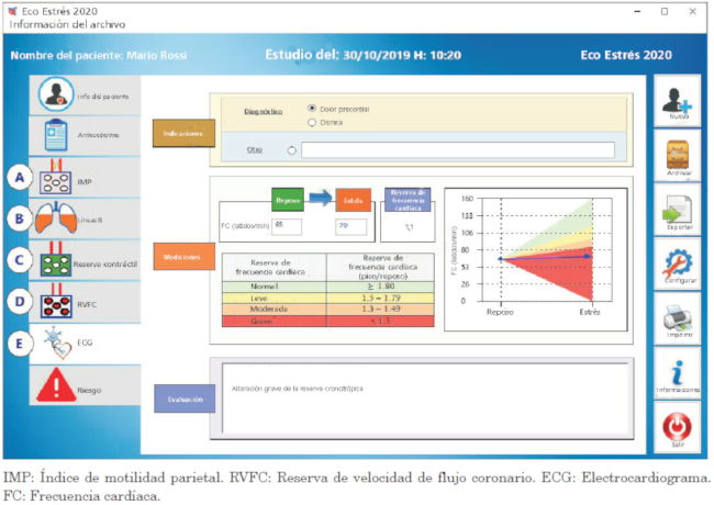 Formulario computarizado de un caso para reserva cronotrópica (fase E) Los datos de frecuencia cardíaca se muestra en reposo y pico de estrés. La gradación de la respuesta se informa en formato tabular (panel derecho superior) y gráfico (panel izquierdo inferior), con el mismo código de colores de la Figura 1 (desde verde, normal, a rojo, anomalía grave).
