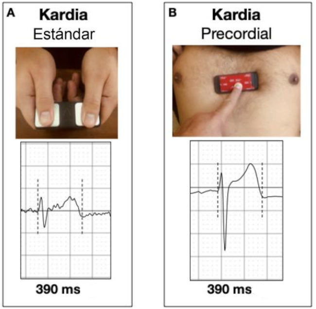 Correspondiente a la Figura 4 A y B del trabajo original