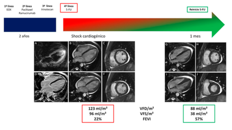 L&iacute;nea de tiempo.