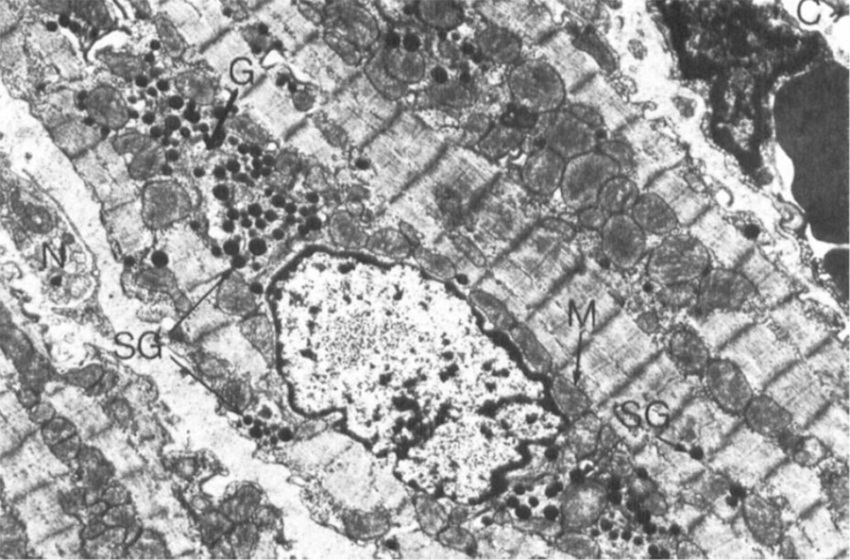 Secci&oacute;n a trav&eacute;s de una porci&oacute;n de la pared auricular de la rata. El n&uacute;cleo sarcopl&aacute;smico central de un m&uacute;sculo auricular. La c&eacute;lula muestra numerosos gr&aacute;nulos espec&iacute;ficos (SG), mitocondrias (M) y perfiles de complejo de Golgi (G). De: De Bold AJ, Bencosme SA. Studies on the relationship between the catecholamine distribution in the atrium and the specific granules present in atrial muscle cells. 1. Isolation of a purified specific granule subfraction. Cardiovasc Res. 1973 May;7(3):351-63. doi: 10.1093/cvr/7.3.351.