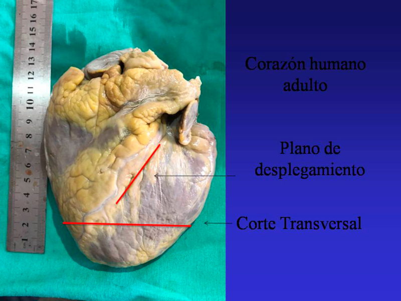 Plano de desplegamiento y corte transversal realizadas en la investigación (corazón humano adulto).