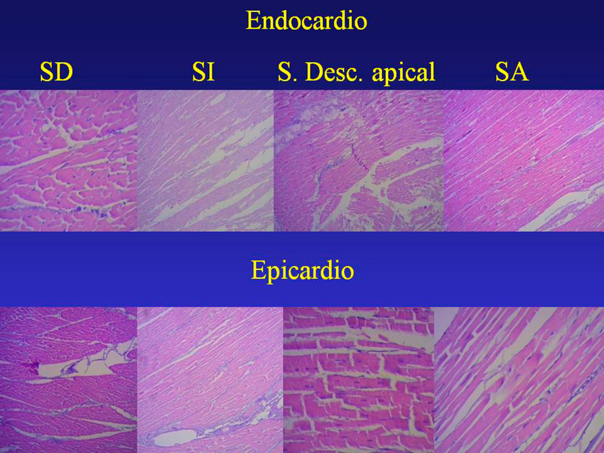 Secuencia segmentaria del análisis histológico del miocardio continuo. Técnica de Hematoxilina-eosina (15x). SD: segmento derecho; SI: segmento izquierdo; S. Desc. (ápex): segmento descendente (ápex); SA: segmento ascendente.