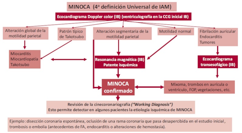 Algoritmo para el diagn&oacute;stico de MINOCA