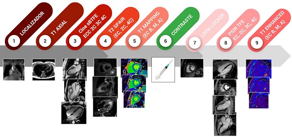 Protocolo de Resonancia Magn&eacute;tica Card&iacute;aca utilizado en el estudio