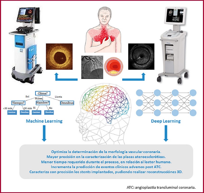 Beneficios aportados por la inteligencia artificial en los m&eacute;todos de im&aacute;genes endovascular