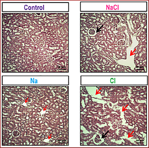 Im&aacute;genes histol&oacute;gicas representativas del par&eacute;nquima renal te&ntilde;idos con H-E. Barra de escala =50 μm. Aumento total 100X. Las fechas en color rojo indican las modificaciones tubulointersticiales y las flechas en color negro la dilataci&oacute;n del espacio urinario. 