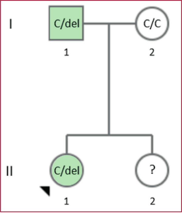 �rbol geneal�gico de la paciente con la variante c.663del. Con verde se identifican a los familiares diagnosticados con HAP. La variante se encontr� en heterocigosis en el caso �ndice y su padre (C/del). El genotipo de la madre fue C/C, por lo que no presenta la variante; mientras que la hermana a�n no fue estudiada. C: citosina; del: deleci�n