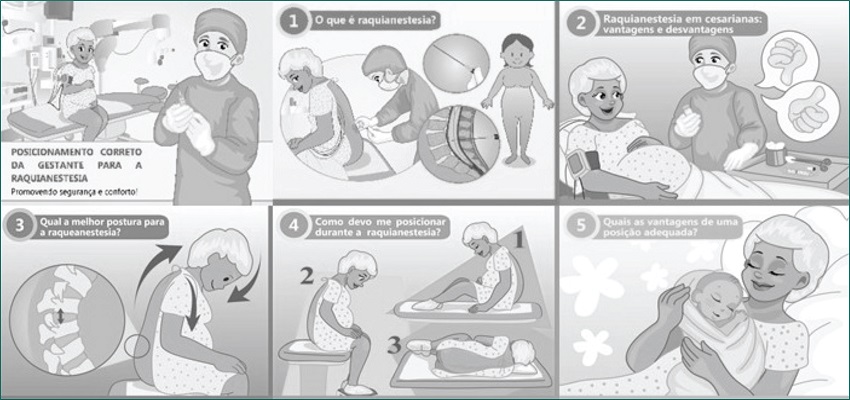 Algumas p&aacute;ginas da vers&atilde;o final do &aacute;lbum seriado sobre posicionamento da gestante para a raquianestesia
