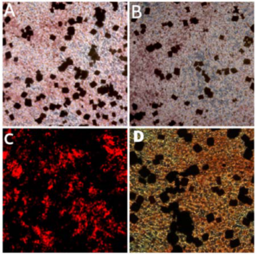 Figure
5. Figure showing the calcium deposition after 14
days. Original magnification x25 (A) experimental β -TCP, (B) Bio-Oss®, (C) β -TCP, (D) control.