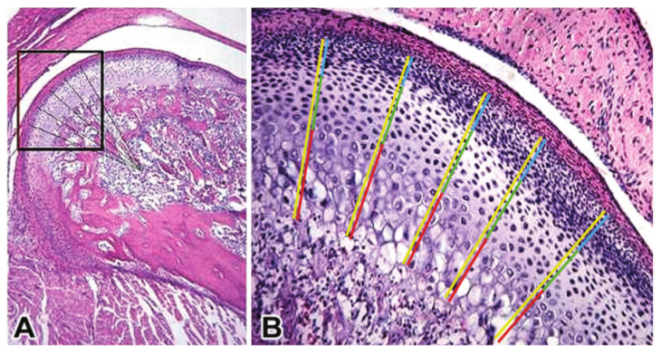 Figure 4. A) 7 μm
histological section of the mandibular condyle of a Wistar rat in the control
group, after 7 days. Note the demarcated area where the images were captured
for analysis (B). Measurements were made following the direction of the dashed
line. B) Posterior region and partof the median region of the condyle, where
total (yellow), proliferative (blue), hyaline (green) and hypertophic (red)
layers were measured.