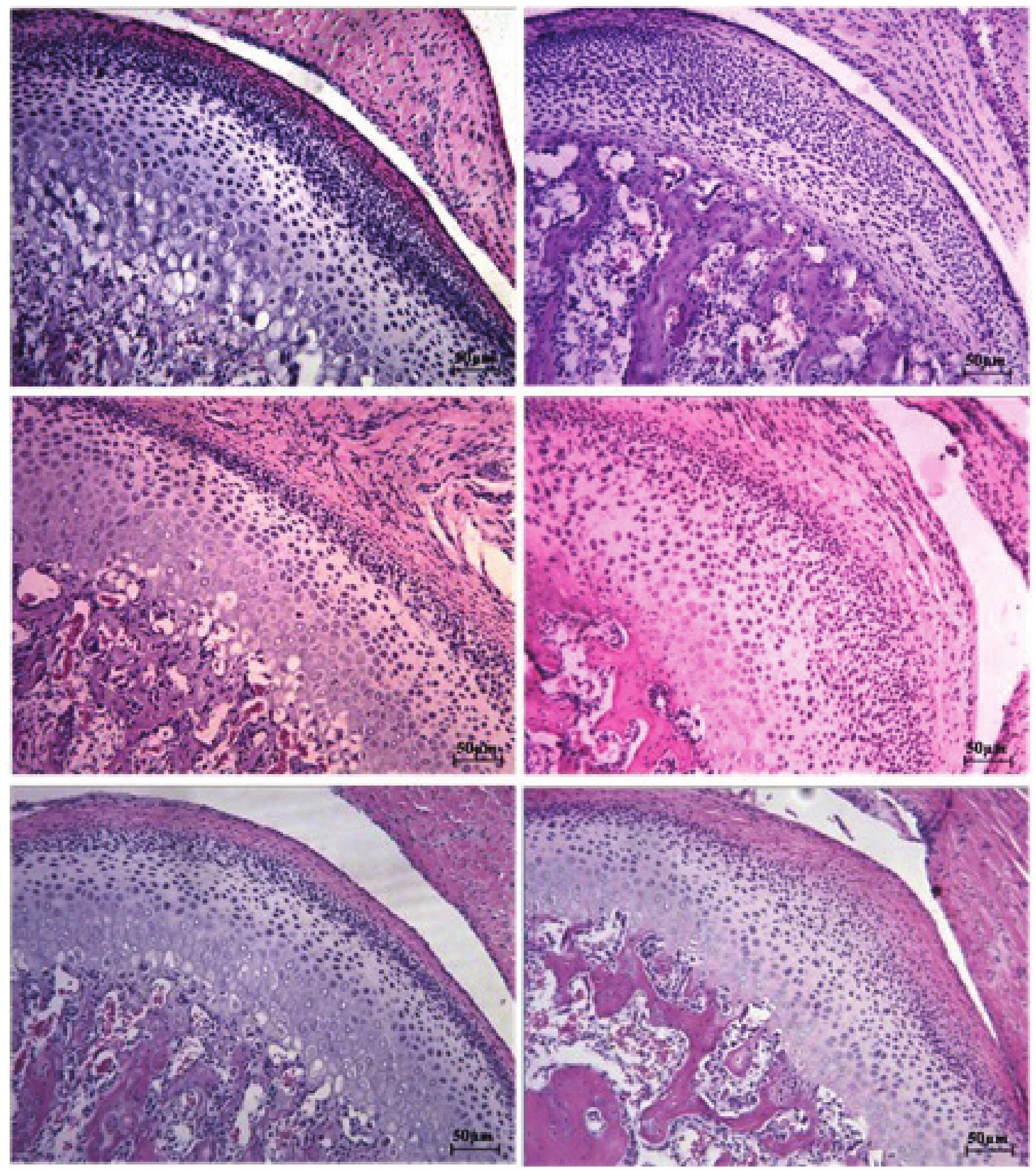 Figure 6.
Photomicrograph of the condylar region of rats showing the proliferative (P), hyaline
(S) and hypertrophic (H) regions of (A) Control group after 7 days; (B)
Experimental group after 7 days; (C) Control group after 21 days; (D)
Experimental group after 21 days; (E) Control group after 30 days; (F)
Experimental group after 30 days. Staining: HE. Calibration bar (50 μm).