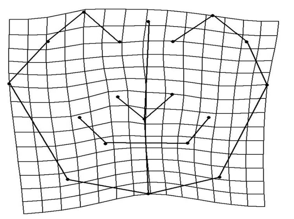 Figure
3. TPS graphical display of shape differences
between mesofacial and the brachyfacial group (magnification factor, X3).