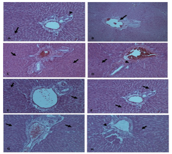 Figure 3. Effect of CAE on histopathological changes of liver tissues (20x). (A) Control group showed typical histological structure of hepatic lobule with central vein [arrowhead] bordering typical hepatic cells [arrows]. (B) CCl4 exposed group showed sustained venous congestion and hepatocytes with feathery disintegration [arrows]. (C) CAE group (400 mg kg-1 bw) showed typical histological structure of hepatic lobule with central vein bordering typical hepatocytes [arrows]. (D) CCl4 + CAE group (400 mg kg-1 bw) showed evident sustained venous congestion with feathery disintegration, absence of steatosis, minimal portal and parenchymal inflammation [arrows]. (E) CCl4 + CAE group (600 mg kg-1 bw) showed hepatocytes structural enhancement with minimal vesicular steatosis [arrows]. (F) CCl4 + post-treatment of CAE group 400 mg/kg bw and (G) 600 mg kg-1 bw showed less percentages of necrosis regenerating hepatocytes. (H) Silymarin group showed hepatoprotective activity with normal sinusoids [arrow] and intact portal veins [arrowhead].