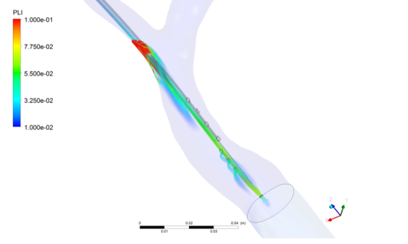 Figure 4. Volumetric distribution of platelet lysis index in the geometry of the internal jugular vein with the Central Venous Catheter.
