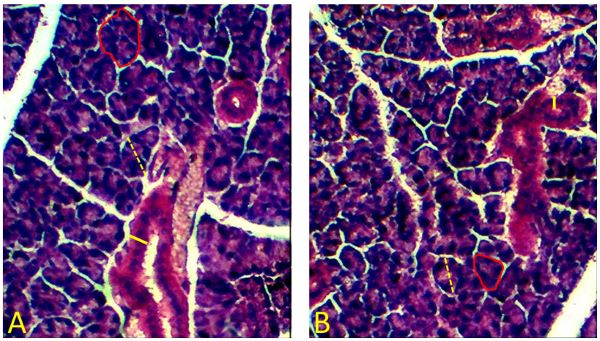 Figure 1. Morphometric analysis of the parotid glands. A: control group. B: treated group. The dashed yellow line indicates the diameter of the acini. The solid yellow line indicates the thickness of the secretory ducts. The red line indicates the perimeter of the acini and delimits their area.
