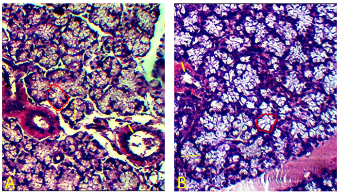 Figure 2. Morphometric analysis of sublingual glands. A: control group. B: treated group. The dashed yellow line indicates the diameter of the acini. The solid yellow line indicates the thickness of the secretory ducts. The red line indicates the perimeter of the acini and delimits their area.