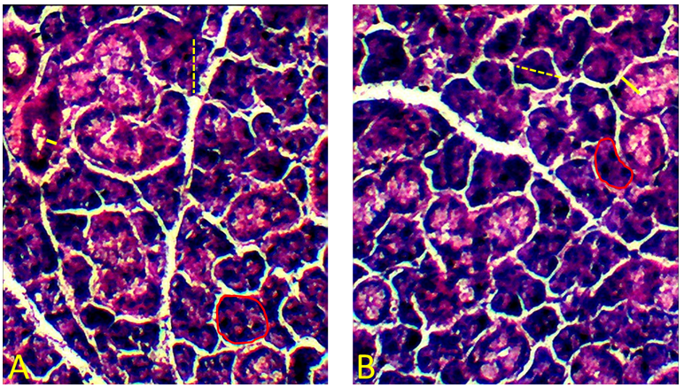 Figure 3. Morphometric analysis of the submandibular glands. A: control group. B: treated group. The dashed yellow line indicates the diameter of the acini. The solid yellow line indicates the thickness of the secretory ducts. The red line indicates the perimeter of the acini and delimits their area.