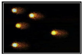 Figure 3.Representative photograph of Comet morphology of patulin group of rats showing grade 2 denotes medium damage (%tail DNA 20-40%)