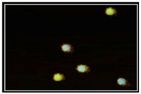 Figure 6. Representative photograph of Comet morphology of patulin group of rats treated for 8 weeks showing grade 1 signifies slight damage (%tail DNA 5-20%).