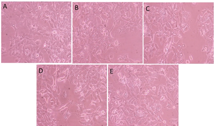 Figure 7. Biological evaluation of
the HepG2 cell line. A: Sample 1 (10th
test before photocatalysis, i.e. RB5 in
solution, t = 0), B: Sample 2 (10th
test after photocatalysis, t = 14 h), C: Sample 3 (21st test before photocatalysis, i.e. RB5 in solution, t = 0), D: Sample 4
(21st test, after photocatalysis, t = 10 h), E: Control cells
without treatment. 20x magnification, inverted microscope.