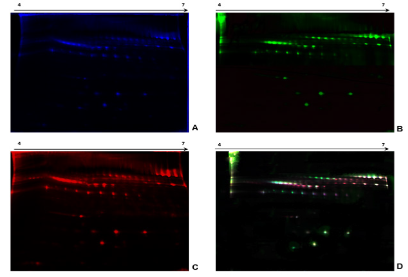 Figura
1. Perfiles representativos del ensayo 2DE-DIGE de
plasma inmunodepletado de pacientes LLA-B y controles.
Se separaron 150μg de plasma por 2D-PAGE usando
tiras IPG de 18cm pH 4 a 7 lineal y geles de poliacrilamida al 13%. Las
imágenes se adquirieron con un escáner de fluorescencia TyphoonTM. A.
fluorescencia azul (Cy2) Estándar interno, B. fluorescencia verde (Cy3)
Pacientes LLA-B, C. fluorescencia roja (Cy5) Controles, D.
Imágenes sobrepuestas con los tres fluorocromos.